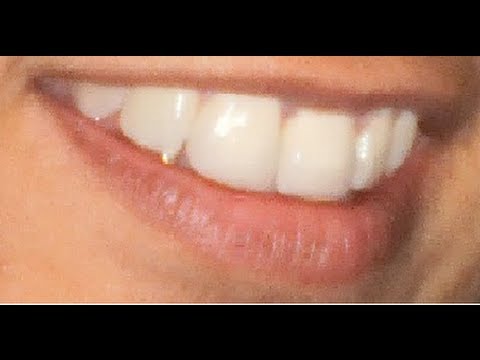 how to rebuild teeth