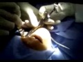 Primeira Cirurgia