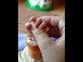 Down syndrome:&nbsp;Down Syndrom: Sind so kleine H�nde