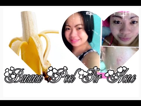 how to use a banana peel for acne