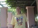 Happy California Patient after Mini-Gastric Bypass