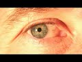 Thumbnail #3