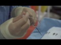 Tests for Heart Conditions in Hospital