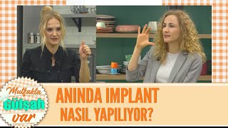 Anında İmplant nasıl yapılıyor? İmplant bak�