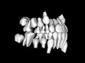 Hi-Tech Digital Teeth Models: AnatoModel Orthodontic Tooth Alignment Simulation