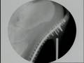 HH X-Ray