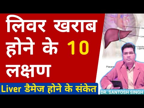 Liver kharab hone ke lakshan/liver damage symptoms/liver damage hone ke lakshan/liver damage sign ••