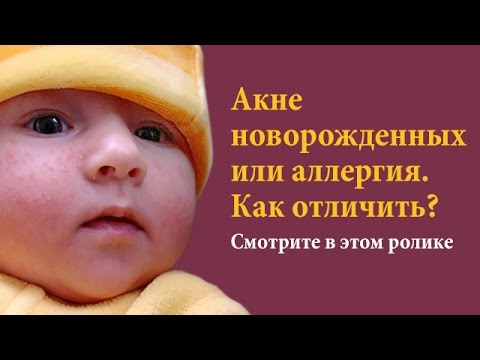 настойка укропа для новорожденных рецепт приготовления в домашних условиях настойка укропа для новорожденных рецепт приготовления в домашних условиях