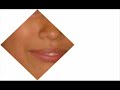Thumbnail #2