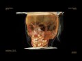Orthodontics In 3D