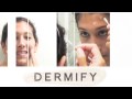 Home Acne Treatment