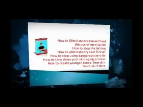 how to not scratch eczema at night