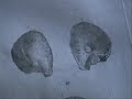 ANATOMY LESSONS FROM THE PAST - BONES AND JOINTS