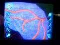 Trauma Center 1-7 Habilidad Latente