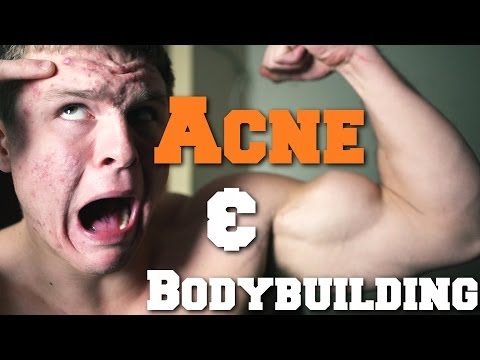 how to clear acne in a week