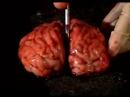 Smoke-Free Bayview Ad [Brains]