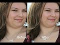 Photoshop tutorial:  Remove blemishes the easy way