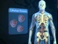 Transplante de Células Tronco