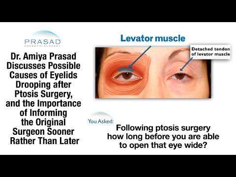 how to treat ptosis