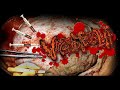 VISCEROMEGALIA ( DENGUE HEMORRHAGIC FEVER)