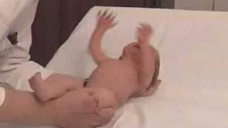 Reflexos Primitivos (Developmental Reflexes)
