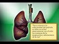 Historia de la Tuberculosis