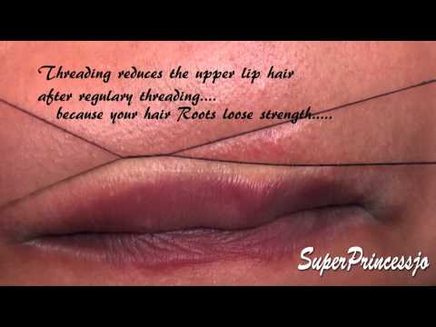 how to remove upper lip hair
