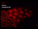 Ovaries 3D recostruction