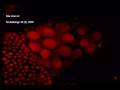 Ovaries 3D recostruction