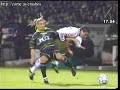 Ever wonder how footballers get broken legs? Ever wonder how footballers get broken legs?