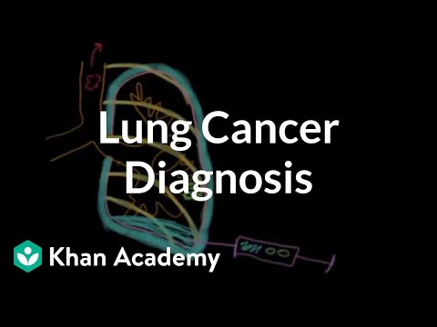 how to discover lung cancer