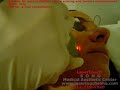 Laser Genesis.wmv