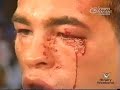 Arturo Gatti HL - slimofmst