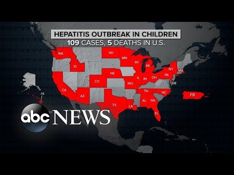 Play this video CDC issues new global alert on hepatitis cases in children  ABCNL
