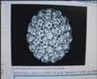Papilloma Virus - Roberto Piva