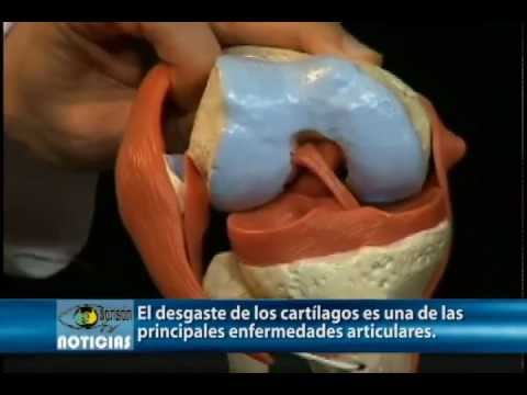 La osteocondrosis de la espalda como luchar