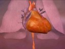 Congestive Heart Failure