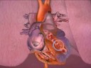 Congestive Heart Failure
