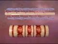 cholesterol containing foods, stages of dying from congestive heart failure