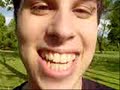 Thumbnail #2
