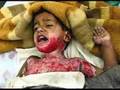 Child Abuse Awareness - Do You Care?