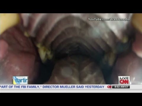 Peek inside a grizzly bear's mouth