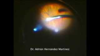Adrián Hernández Martínez-15