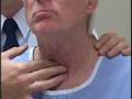 Thyroid Examination