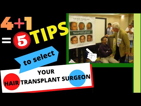 hair transplantation in India - http://www.hairtransplant-india.org Selecting your doctor for your FUE hair transplant may make you loose some more hair! Here are some tips that may help yo...