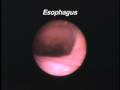 Fiber-optic Trachea vs Esophagus