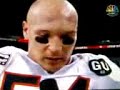 Chicago Bears - Urlacher Interview