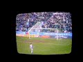 Hibs vs Gretna Hibs vs Gretna