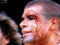 Rockets Shane Battier jacked up & bloodied by Lakers Sasha Vujacic