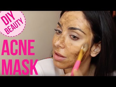 My Favorite Acne Miracle Mask! \\ خلطة طبيعيّة لمعالجة حبّ الشباب
